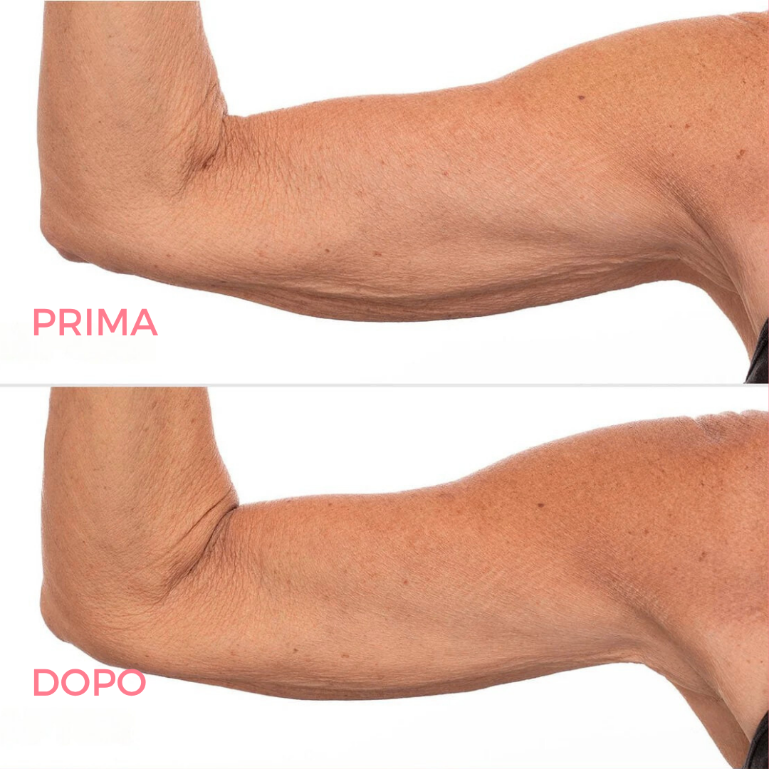 Firming and Toning Cream for Arms