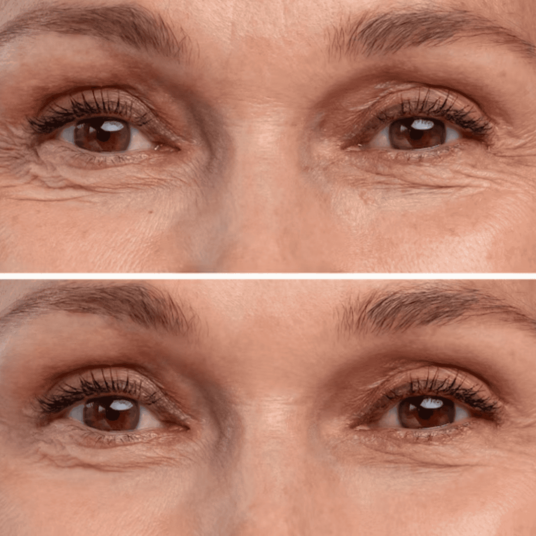 Collagen Facial Serum (30ml)