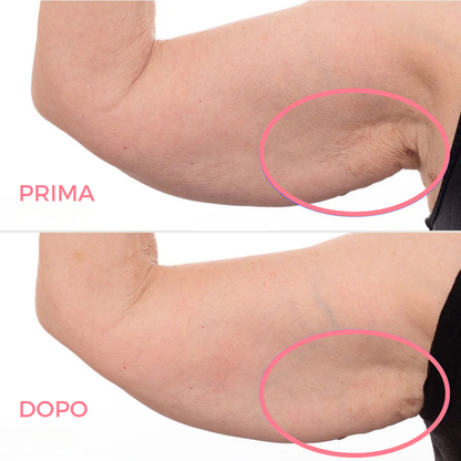 Firming and Toning Cream for Arms