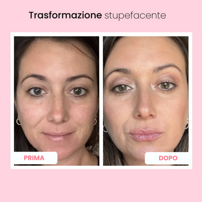 Lip volumizing roller