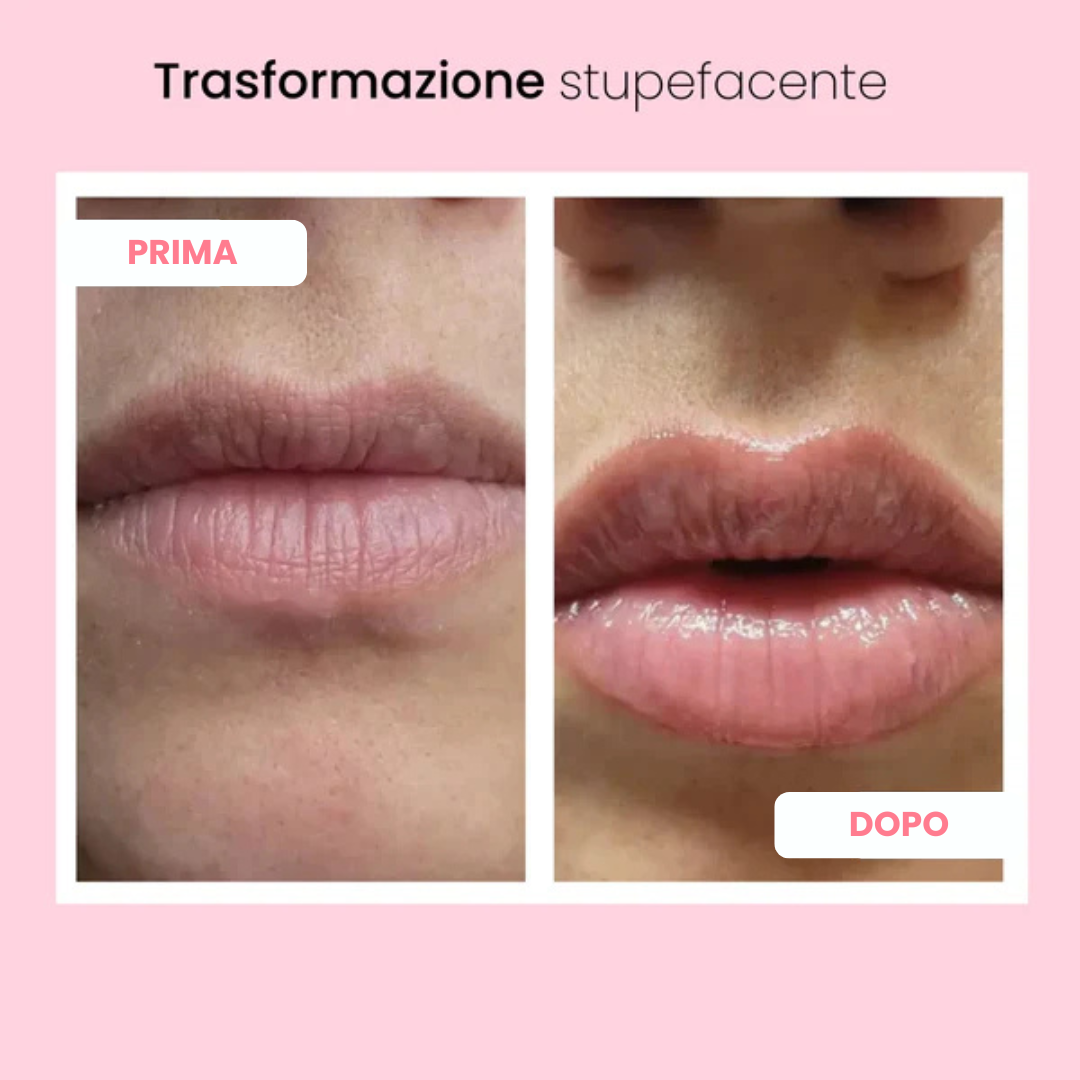 Lip volumizing roller