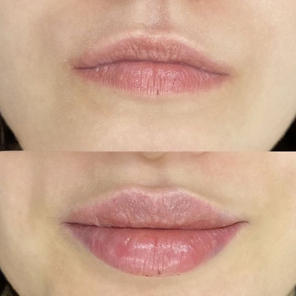 Collagen lip plumping mask