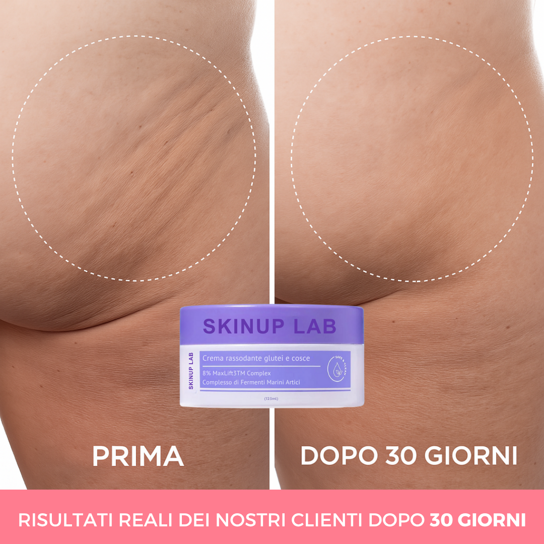 Firming cream for buttocks and thighs