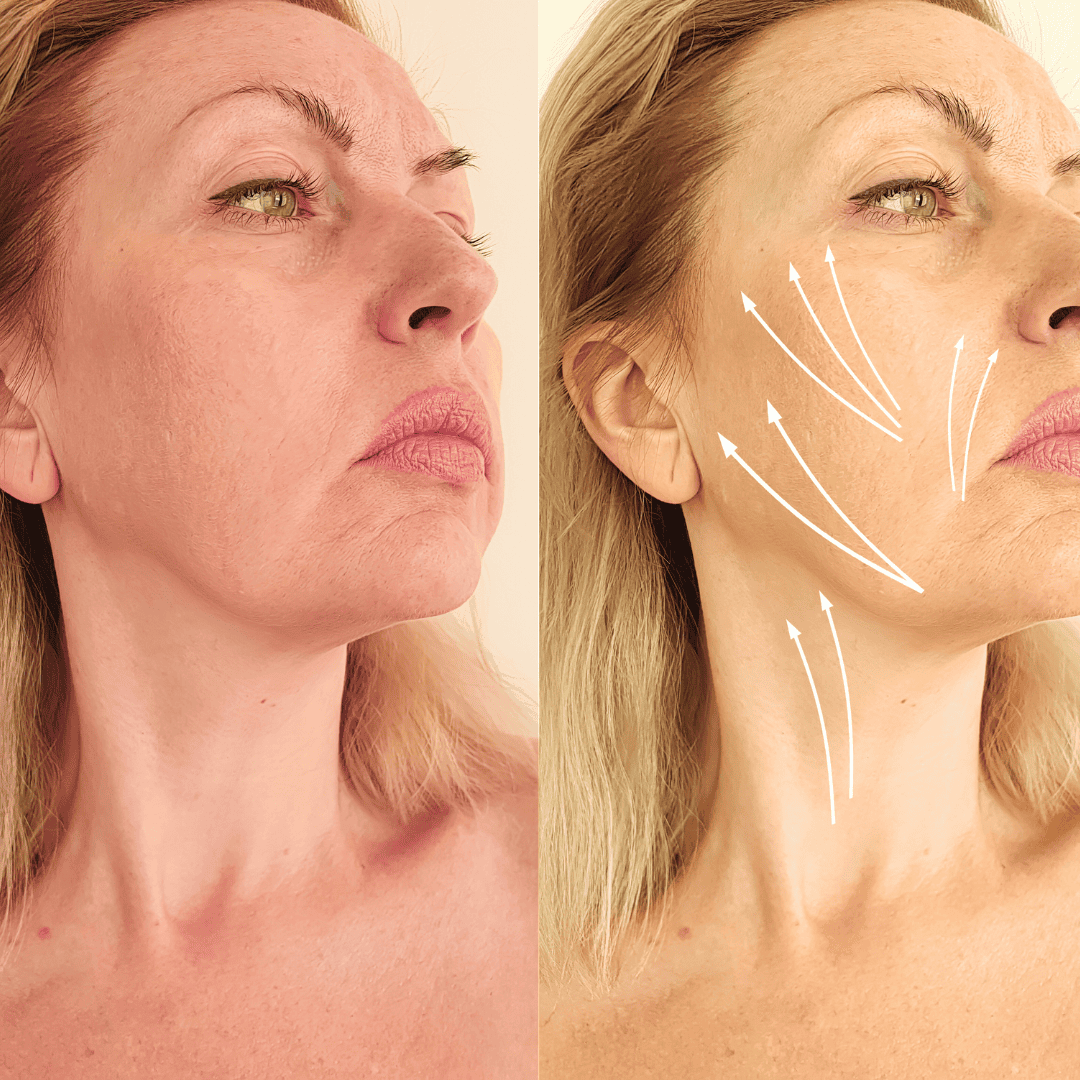 Crema Solare Spray al Collagene (150ml)